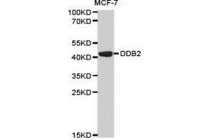 Western Blotting (WB) image for anti-Damage-Specific DNA Binding Protein 2, 48kDa (DDB2) antibody (ABIN1872225) (DDB2 Antikörper)
