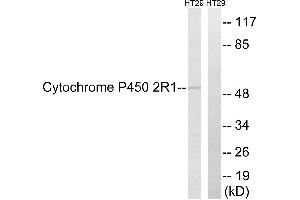 Immunohistochemistry analysis of paraffin-embedded human colon carcinoma tissue using Cytochrome P450 2R1 antibody.