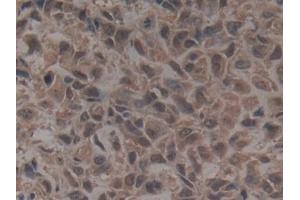 Immunohistochemistry (IHC) image for anti-Golgi Glycoprotein 1 (GLG1) (AA 1048-1145) antibody (ABIN7439525)