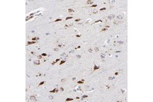 Immunohistochemical staining (Formalin-fixed paraffin-embedded sections) of human cerebral cortex with RRAGB polyclonal antibody  shows strong cytoplasmic positivity in neuronal cells. (RRAGA Antikörper)