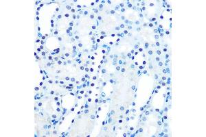 Immunohistochemistry of paraffin-embedded mouse kidney using M/M/ML1 Rabbit mAb (ABIN7268354) at dilution of 1:100 (40x lens). (MAD2L1 Antikörper)