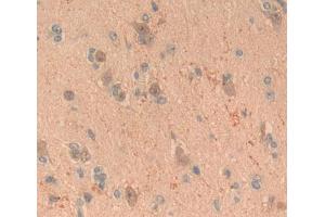 Used in DAB staining on fromalin fixed paraffin- embedded brain tissue (FGF20 Antikörper  (AA 1-211))