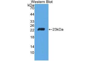 Detection of Recombinant CD6, Mouse using Polyclonal Antibody to Cluster Of Differentiation 6 (CD6) (CD6 Antikörper  (AA 30-204))