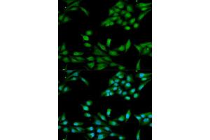 Immunofluorescence analysis of HeLa cell using MSH2 antibody. (MSH2 Antikörper  (AA 1-300))