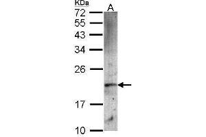 WB Image Sample (30 ug of whole cell lysate) A: A549 12% SDS PAGE antibody diluted at 1:1000 (FTH1 Antikörper  (Center))