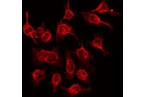 ABIN6275405 staining Hela by IF/ICC. (NDRG3 Antikörper  (Internal Region))