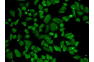 Immunofluorescence analysis of A549 cell using ALDH2 antibody.