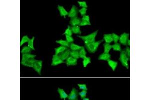 Immunofluorescence analysis of A549 cells using HAPLN1 Polyclonal Antibody (HAPLN1 Antikörper)