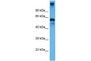 Host:  Mouse  Target Name:  P4HB  Sample Tissue:  Mouse Small Intestine  Antibody Dilution:  1ug/ml (P4HB Antikörper  (C-Term))