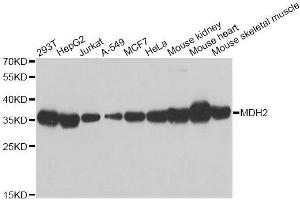 Western blot analysis of extracts of various cell lines, using MDH2 antibody. (MDH2 Antikörper  (AA 59-338))