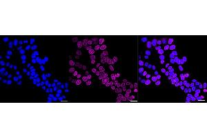 Immunocytochemical staining of HAP-1 cells with Lamin B receptor antibody (ABIN7799230), 1:1,000). (Rekombinanter Lamin B Receptor Antikörper)