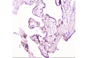 IHC analysis of TANK using anti-TANK antibody (ABIN6719508). (TANK Antikörper)
