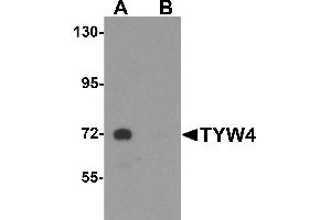 Western blot analysis of TYW4 in rat brain tissue lysate with TYW4 antibody at 1 µg/mL in (A) the absence and (B) the presence of blocking peptide. (LCMT2 Antikörper  (N-Term))