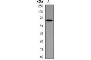 Western blot analysis of MT-ND5 expression in mouse brain (A) whole cell lysates.