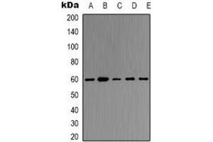 Western blot analysis of TRAF6 expression in Hela (A), K562 (B), Rat kidney (C), Rat heart (D), mouse kidney (E) whole cell lysates. (TRAF6 Antikörper)