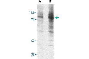 Western blot analysis of LAMP1 in EL4 cell lysate with LAMP1 polyclonal antibody  at (A) 1 and (B) 2 ug/mL . (LAMP1 Antikörper  (Internal Region))
