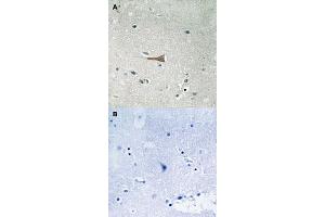 Immunohistochemical staining of human brain tissue by DDR1 (phospho Y513) polyclonal antibody  without blocking peptide (A) or preincubated with blocking peptide (B) under 1:50-1:100 dilution. (DDR1 Antikörper  (pTyr513))
