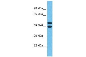 Western Blotting (WB) image for anti-Olfactory Receptor, Family 4, Subfamily Q, Member 3 (OR4Q3) (C-Term) antibody (ABIN2791740)