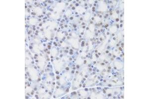 Immunohistochemistry of paraffin-embedded rat pancreas using MCM4 Antibody (ABIN5971548) at dilution of 1/100 (40x lens). (MCM4 Antikörper)