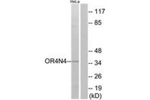 Western blot analysis of extracts from HeLa cells, using OR4N4 Antibody. (OR4N4 Antikörper  (AA 56-105))