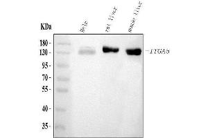 Western blot analysis of ITGA5 using anti-ITGA5 antibody (ABIN3043256).