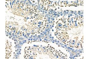 ABIN6259565 and ABIN6275780 at 1/100 staining Mouse testis tissue by IHC-P. (MX2 Antikörper  (Internal Region))