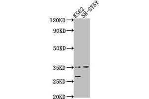 Western Blot Positive WB detected in: K562 whole cell lysate, SH-SY5Y whole cell lysate All lanes: THOC6 antibody at 1:2000 Secondary Goat polyclonal to rabbit IgG at 1/50000 dilution Predicted band size: 38, 35, 33 kDa Observed band size: 35 kDa (THOC6 Antikörper  (AA 56-315))