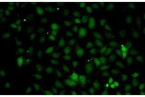 Immunofluorescence analysis of A-549 cells using C1S Polyclonal Antibody (C1S Antikörper)