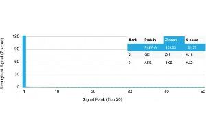 Analysis of Protein Array containing more than 19,000 full-length human proteins using PAPP-A Mouse Monoclonal Antibody (PAPPA/2715) Z- and S- Score: The Z-score represents the strength of a signal that a monoclonal antibody (MAb) (in combination with a fluorescently-tagged anti-IgG secondary antibody) produces when binding to a particular protein on the HuProtTM array. (PAPPA Antikörper  (AA 351-523))