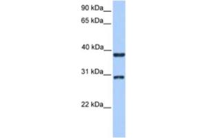 Western Blotting (WB) image for anti-Kelch Domain Containing 1 (KLHDC1) antibody (ABIN2463544) (KLHDC1 Antikörper)