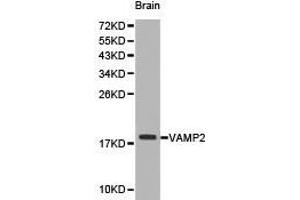 Western Blotting (WB) image for anti-Vesicle-Associated Membrane Protein 2 (Synaptobrevin 2) (VAMP2) antibody (ABIN1875306) (VAMP2 Antikörper)