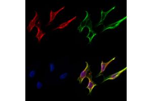 ABIN6264480 and ABIN6277000 staining Hela cells by IF/ICC.
