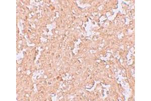 Immunohistochemistry (IHC) image for anti-Zinc Finger and BTB Domain Containing 8A (ZBTB8A) (C-Term) antibody (ABIN1030814) (ZBTB8A Antikörper  (C-Term))