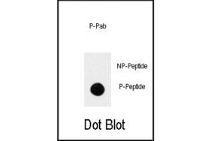 Image no. 1 for anti-Neurotrophic Tyrosine Kinase, Receptor, Type 1 (NTRK1) (pTyr791) antibody (ABIN358249)