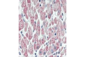 Immunhistochemistry analysis in human heart tissue (Formalin-fixed, Paraffin-embedded) using USP19  (USP19 Antikörper  (Internal Region))