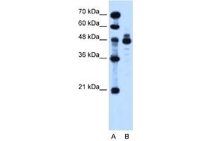 IHH antibody used at 1. (Indian Hedgehog Antikörper)