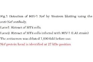 Western Blotting (WB) image for anti-HIV-1 Nef (full length) antibody (ABIN2452025) (HIV-1 Nef (full length) Antikörper)