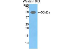 Western blot analysis of the recombinant protein. (LEFTY1 Antikörper  (AA 169-368))