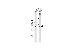 All lanes : Anti-hPHO1-M1 at 1:2000 dilution Lane 1: Jurkat whole cell lysate Lane 2: Raji whole cell lysate Lysates/proteins at 20 μg per lane. (Phosphate Transporter PHO1 (AA 1-30), (N-Term) Antikörper)