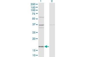Western Blot analysis of FAU expression in transfected 293T cell line by FAU monoclonal antibody (M03), clone 3C10. (FAU Antikörper  (AA 1-133))
