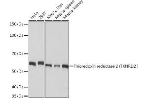 Western blot analysis of extracts of various cell lines, using Thioredoxin reductase 2 (Thioredoxin reductase 2 (TXNRD2 ) ) Rabbit mAb (ABIN7270807) at 1:1000 dilution. (TXNRD2 Antikörper)