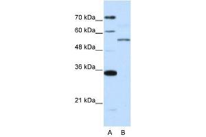 ZNF707 antibody used at 0. (ZNF707 Antikörper  (N-Term))