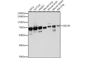 Western blot analysis of extracts of various cell lines, using CDC40 Rabbit mAb (ABIN7266255) at 1:1000 dilution. (CDC40 Antikörper)