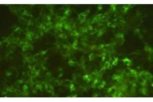 Fluorescence image of a culture of SiMa human neuroblastoma cells, pretreated for 12 h with 10 μg/ml of α-CJe, and after fixation stained for TH, revealing an intense cytoplasmic labeling in most of the cells (Campylobacter jejuni Antikörper)