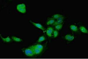 Immunofluorescent analysis of Hela cells using ABIN7159497 at dilution of 1:100 and Alexa Fluor 488-congugated AffiniPure Goat Anti-Rabbit IgG(H+L) (TIMP4 Antikörper  (AA 31-224))