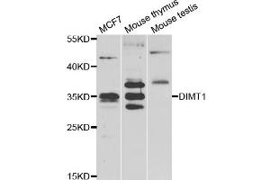 Western blot analysis of extracts of various cell lines, using DIMT1 antibody. (DIMT1 Antikörper)