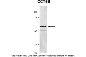 Sample Type: HEK 293 (10ug)Primary Dilution: 1:1000Secondary Antibody: conjugated goat anti-rabbitSecondary Dilution: 1:10,000Image Submitted By: Amy GrayBrigham Young University (Importin 5 Antikörper  (N-Term))