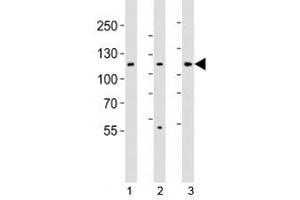 Western Blotting (WB) image for anti-Janus Kinase 1 (JAK1) (N-Term) antibody (ABIN3028774)
