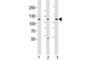 Western blot analysis of lysate from 1) HT-29, 2) HeLa, and 3) Jurkat cell line using JAK1 antibody (JAK1 Antikörper  (N-Term))