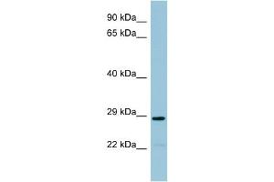WB Suggested Anti-NAT8B Antibody Titration:  0.